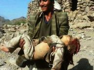 واشنطن تسمح للمملكة العربية السعودية بارتكاب الفظاعات في اليمن  ومن ثم تجبر الأمم المتحدة على الصمت